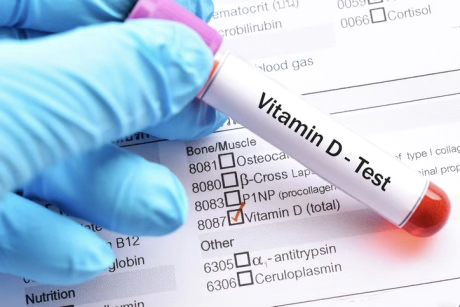 Anàlisi Vitamina D